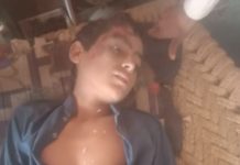 ونجاری میں لیاقت مارکیٹ کےقریب موٹرسائیکل کے حادثےسےتیسری جماعت کاطالب علم عطاءاللہ شدید زخمی۔ماضی میں بھی تیز رفتار گاڑیوں کی وجہ سےحادثات پیش آچکے ہیں۔